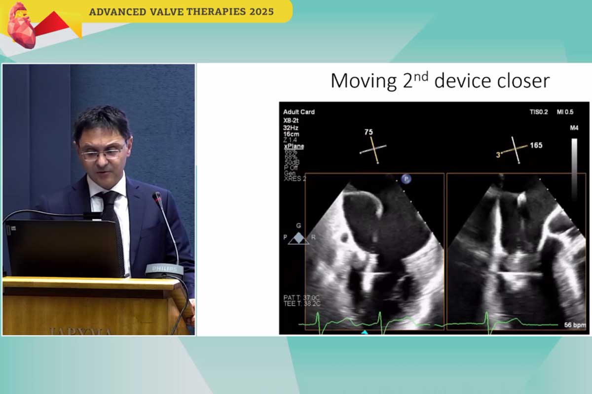 kamc-advanced-valve-therapies.jpg